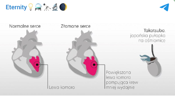 Zrzut ekranu 2025-07-14 214604.png
